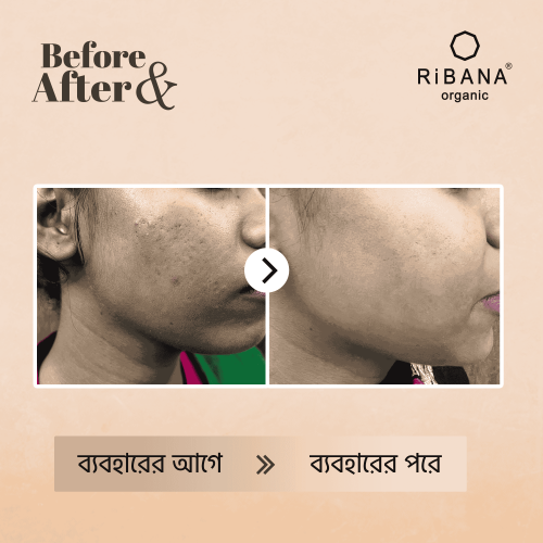Ribana Before after-500x500